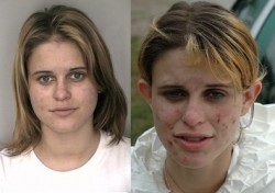 meth signs of use